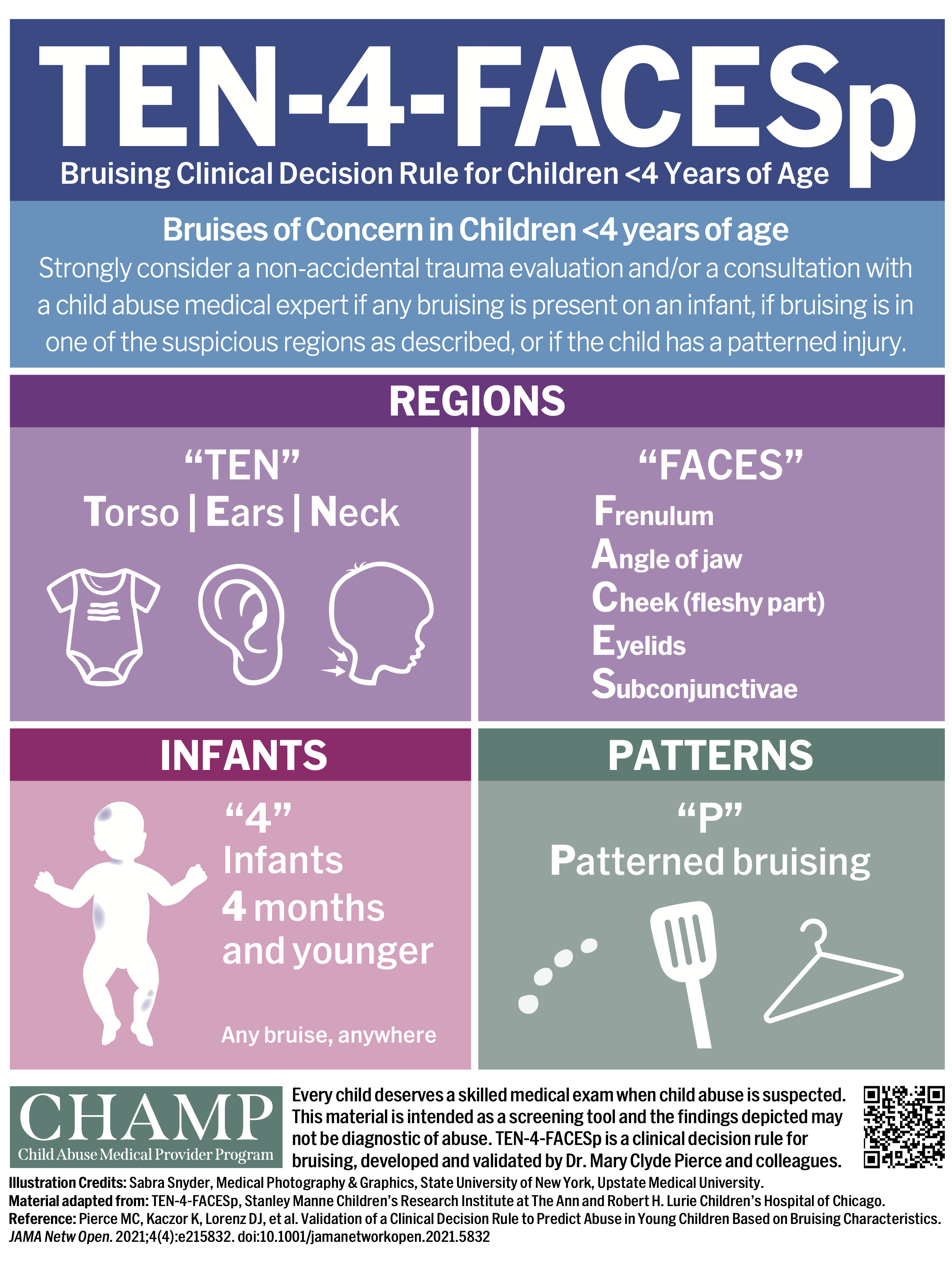 TEN-4-FACESp rules for evaluating bruising in children under 4 years of age