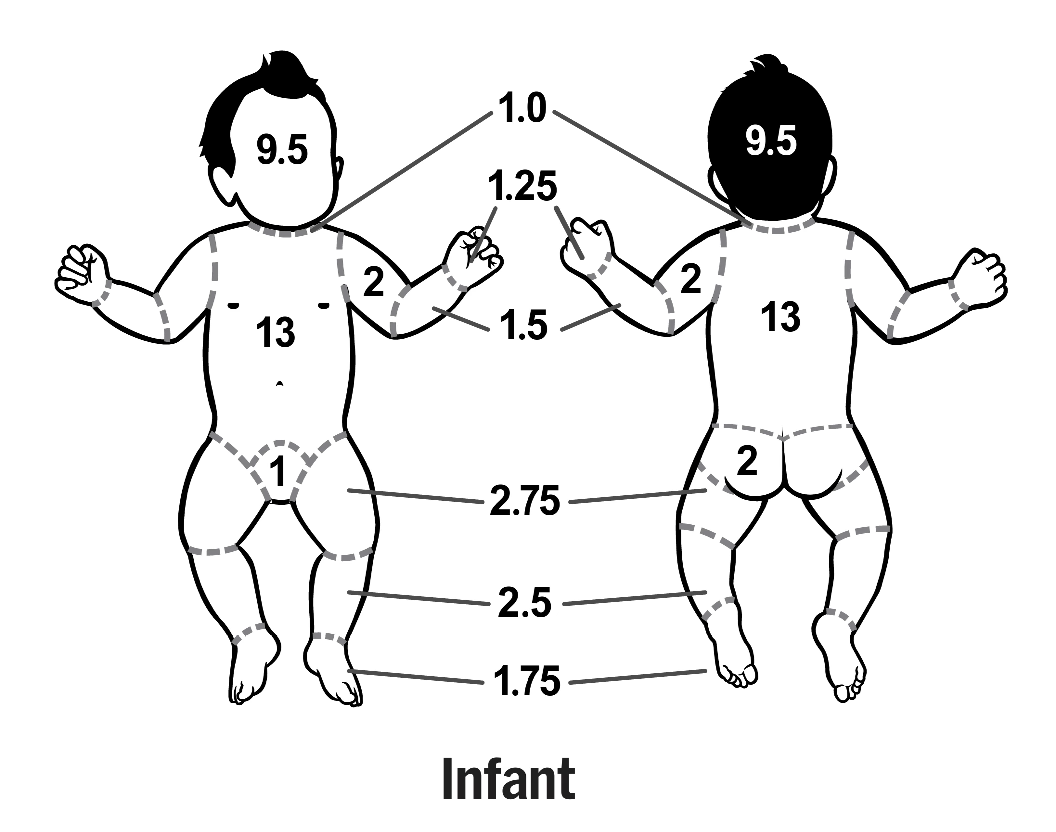 Front and back diagrams of an infant with numbered areas